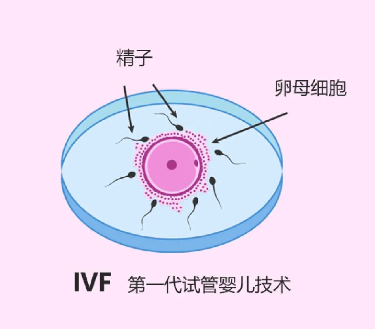 移植冻胚两天后吃了芒果，会影响胚胎着床吗？