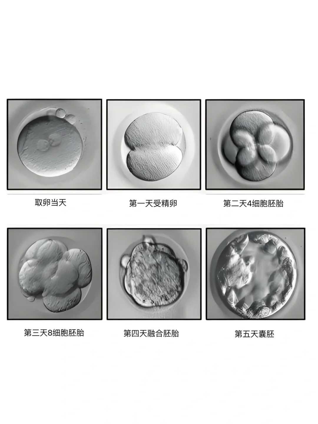 从中国去乌克兰做试管婴儿需要多少费用？包含哪些项目？