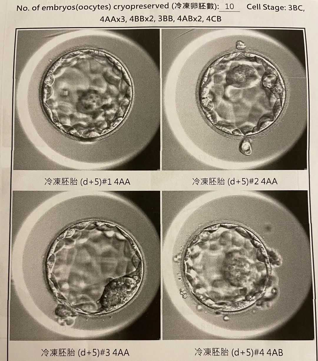捐卵代怀&有几间代生公司,试管婴儿囊胚植入费用，试管婴儿囊胚移植成功率高吗