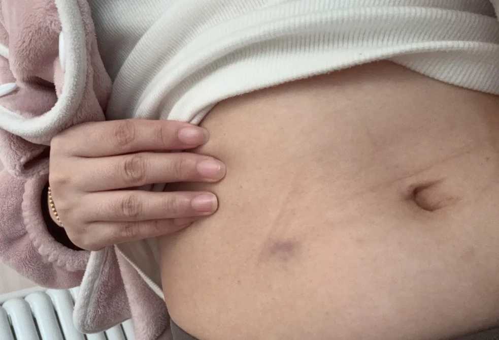 超高龄女性做试管婴儿安全吗，有哪些利弊？