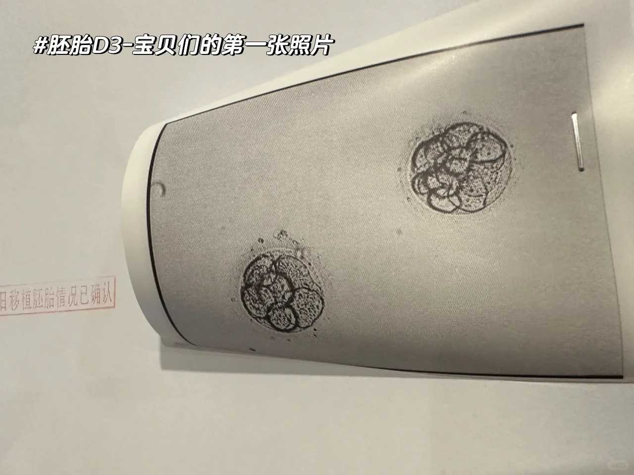 江西哪些公立医院做供卵试管，不需要排队？