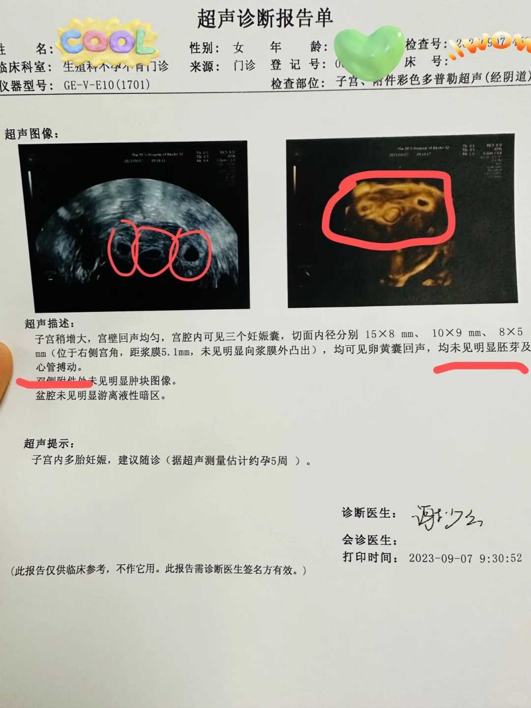 上海九院做供卵试管，请问需要多少钱？